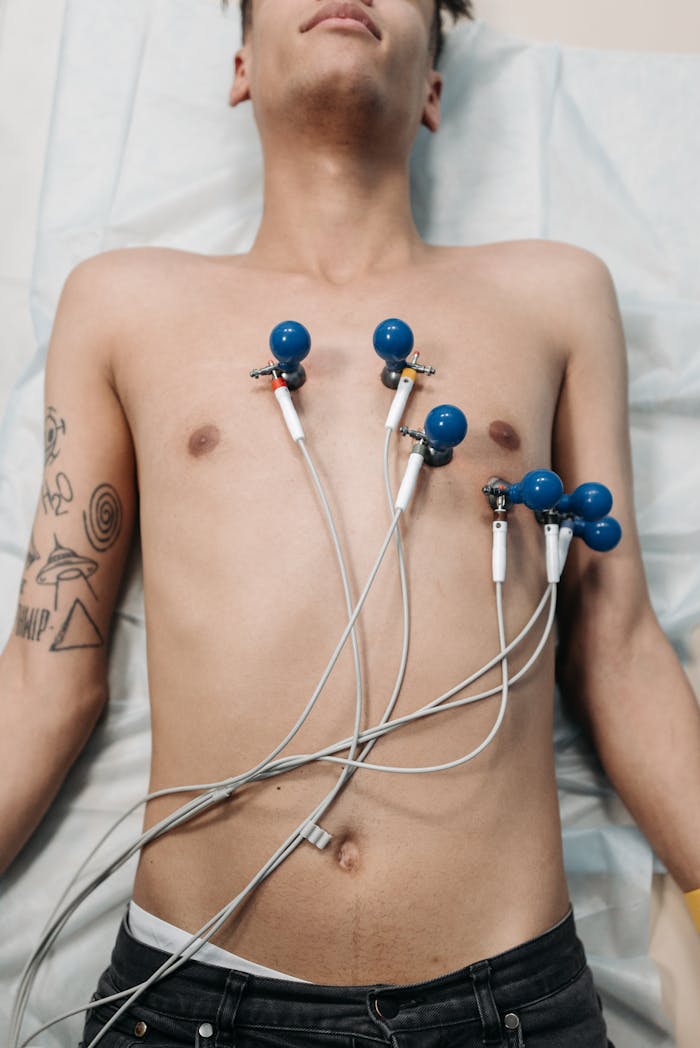 A young man lying down for an ECG procedure with electrodes attached to his chest.